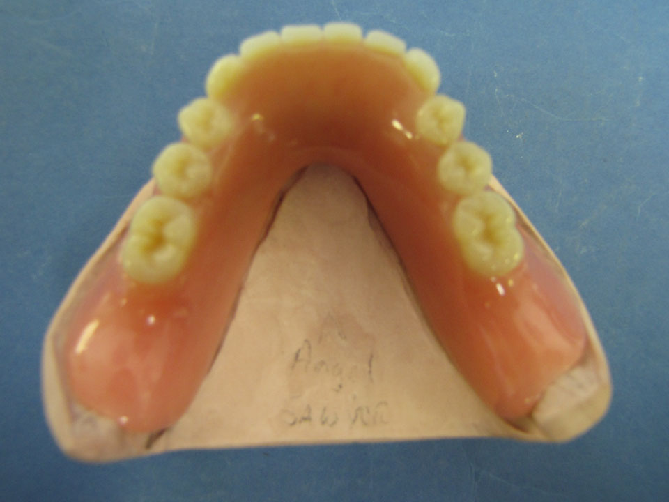 Various dentures finishes. Fiber Force and metal reinforcement available